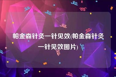 帕金森针灸一针见效(帕金森针灸一针见效图片)